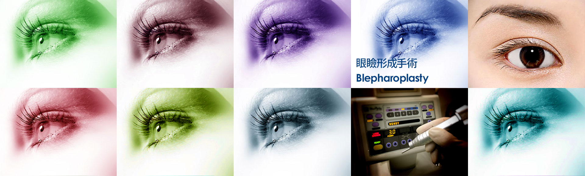 眼瞼形成手術 Blepharoplasty