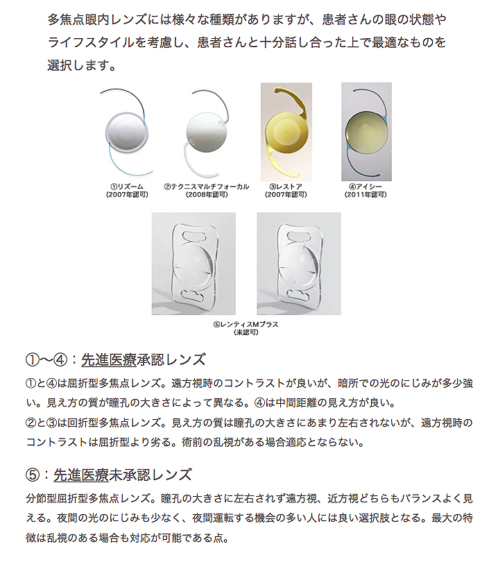 多焦点眼内レンズの種類と特徴