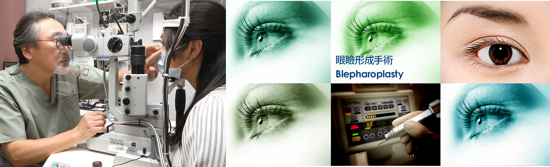眼瞼形成手術 Blepharoplasty